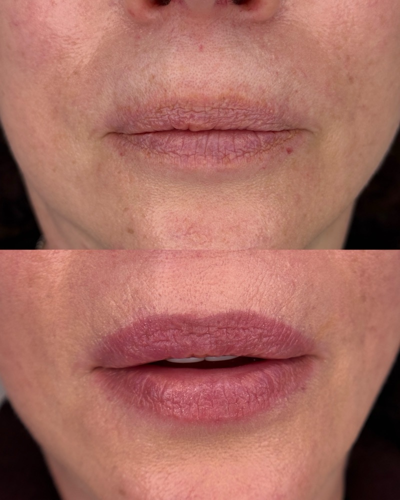 Lip blushing, before and after
